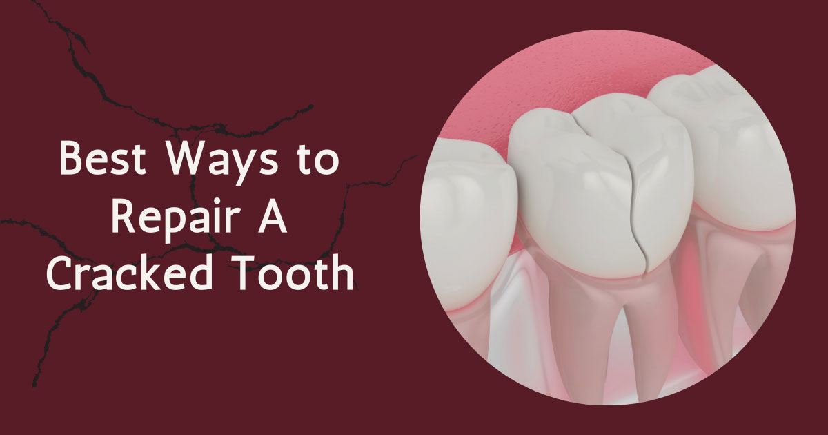 How To Fix A Cracked Tooth In Okc Saxon Dentistry