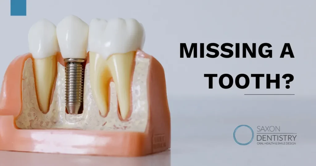 Missing A Tooth Blog