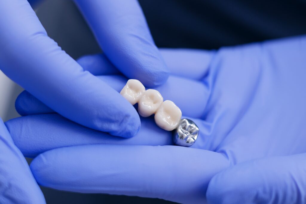 Dentist Holding Dental Crowns Prosthesis