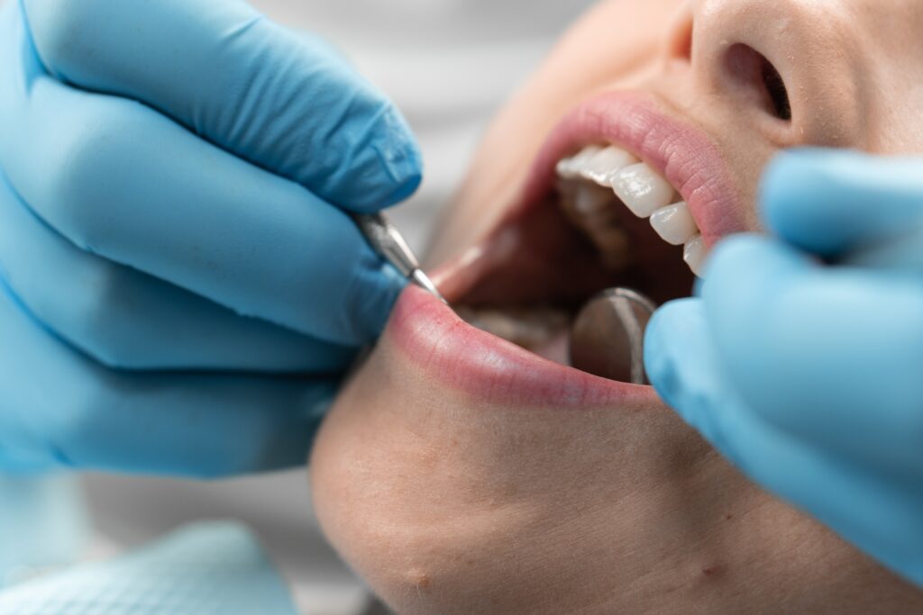What to Look for When Choosing a Cosmetic Dentist in Oklahoma City